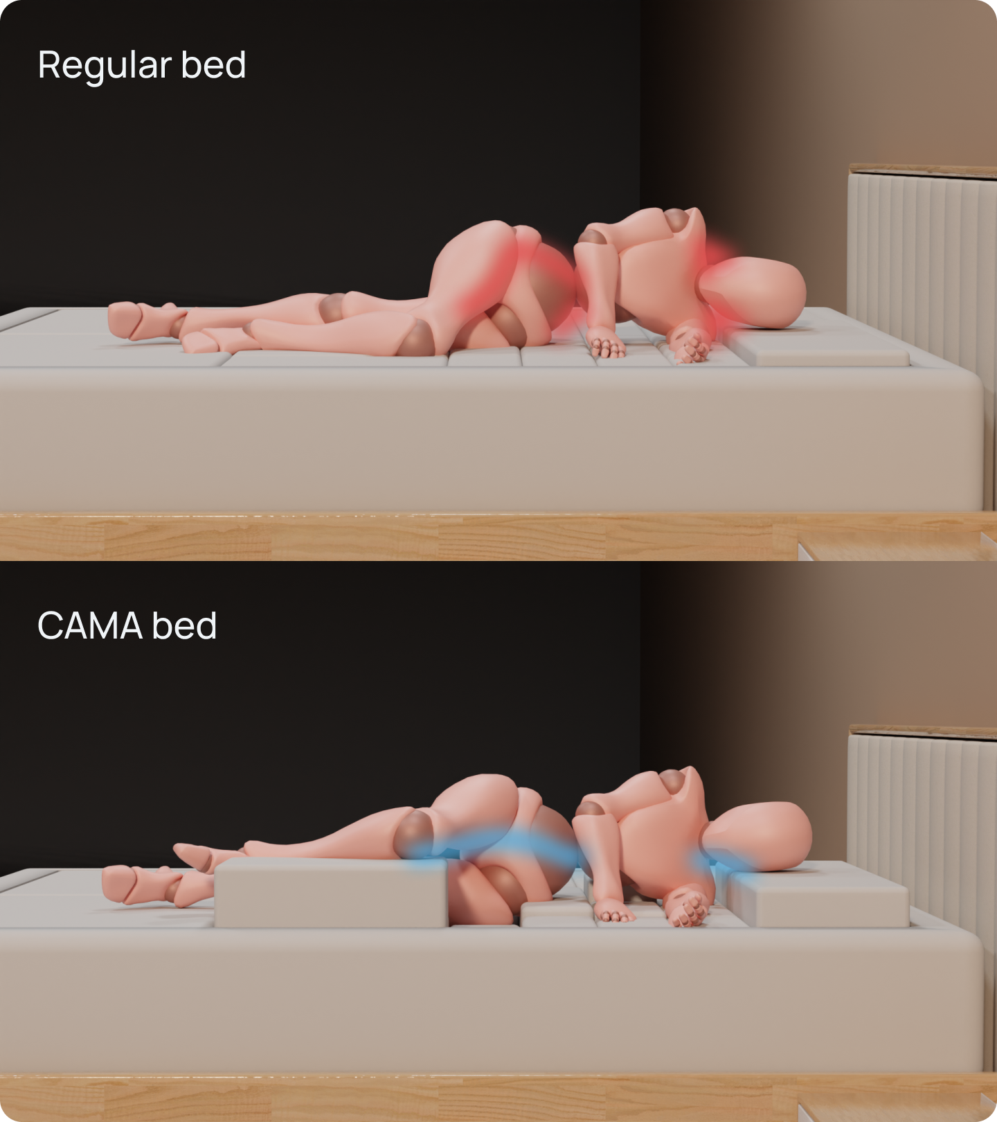 Regular bed vs. CAMA bed